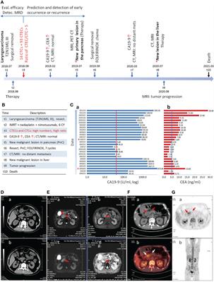 Case report: Post-therapeutic laryngeal  carcinoma patient possessing a high ratio of aneuploid CTECs to CTCs rapidly developed de novo malignancy in pancreas